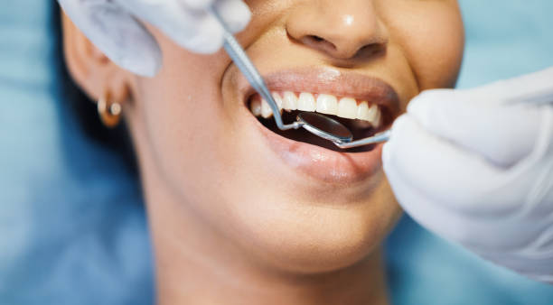 Best Emergency Treatment for Toothache in Ottawa, IL