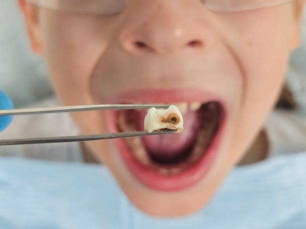 Best Emergency Treatment for Toothache in Ottawa, IL